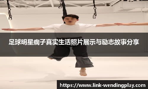 足球明星瘸子真实生活照片展示与励志故事分享